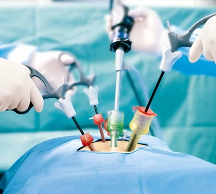 Laparoscopic Surgeries